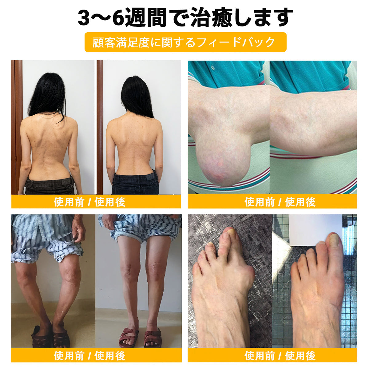 🎉 残りわずか5箱！さらに30％の追加割引！ 健康で理想の体を手に入れましょう。今行動しないと、次のチャンスは来年までありません！