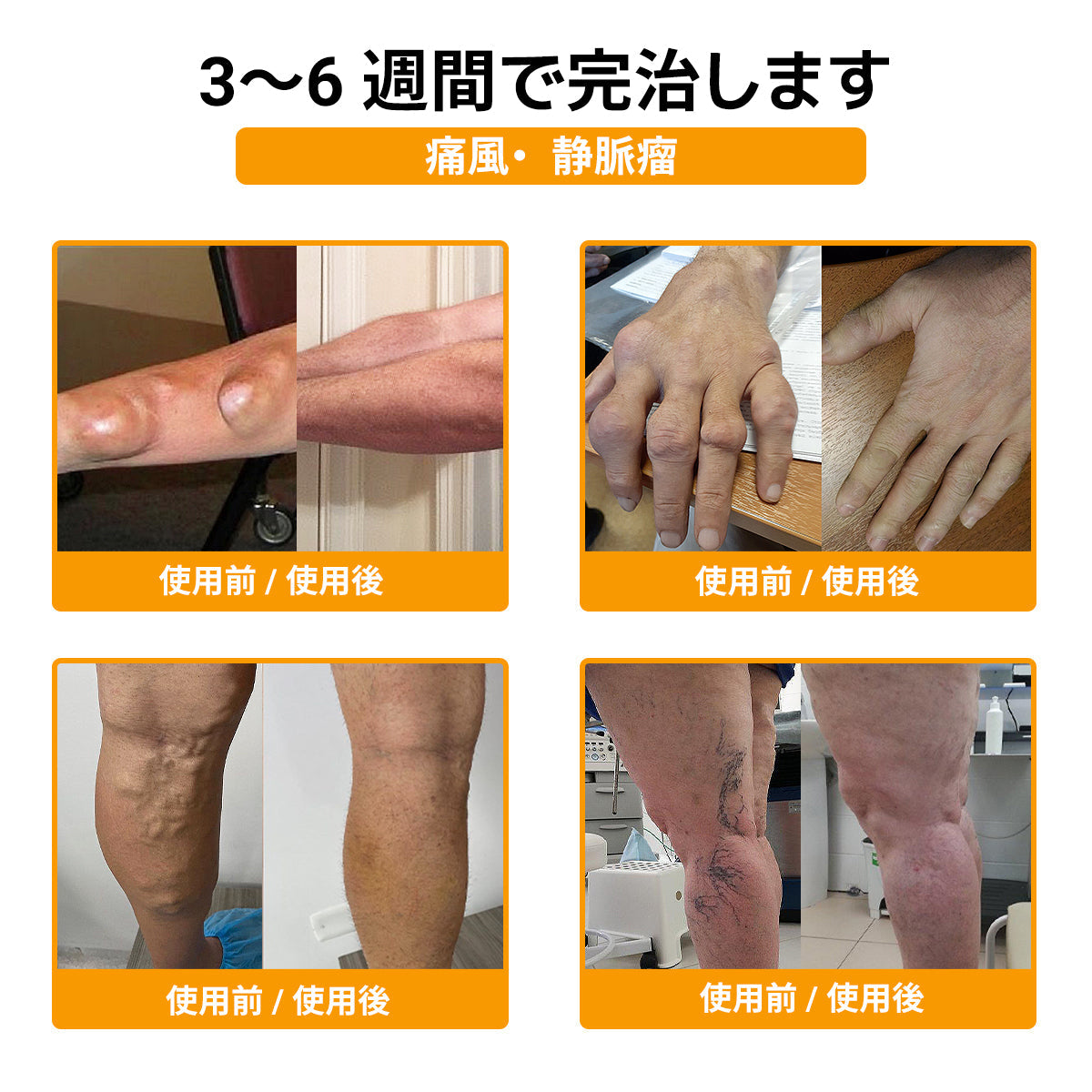 🎉 残りわずか5箱！さらに30％の追加割引！ 健康で理想の体を手に入れましょう。今行動しないと、次のチャンスは来年までありません！