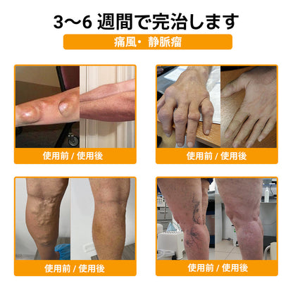 🎉 残りわずか5箱！さらに30％の追加割引！ 健康で理想の体を手に入れましょう。今行動しないと、次のチャンスは来年までありません！