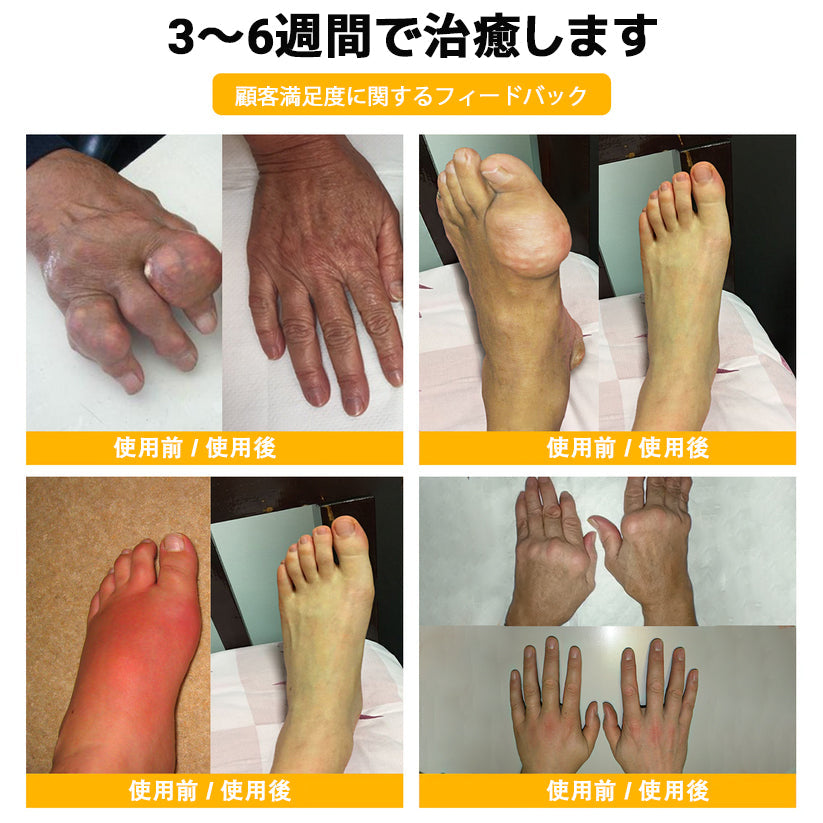 🎉 残りわずか5箱！さらに30％の追加割引！ 健康で理想の体を手に入れましょう。今行動しないと、次のチャンスは来年までありません！