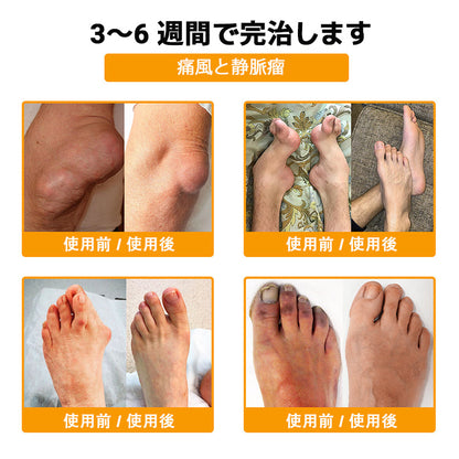 🎉 残りわずか5箱！さらに30％の追加割引！ 健康で理想の体を手に入れましょう。今行動しないと、次のチャンスは来年までありません！